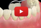 Educational Videos